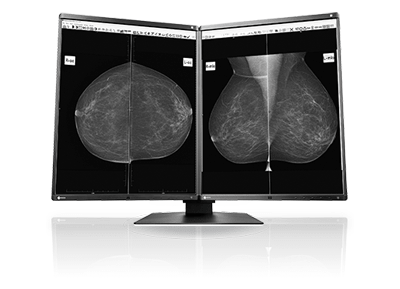 eizo medical monitor price